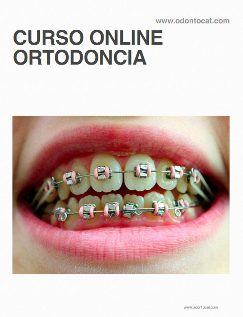 Odontocat: Curso Online De Ortodoncia