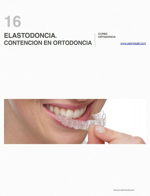 Odontocat: Curso Online De Ortodoncia