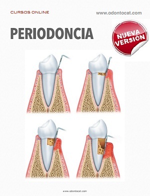 Curso de Periodoncia