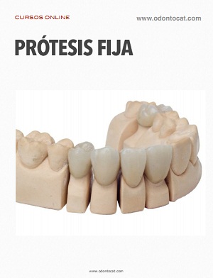 Curso de Prótesis Fija