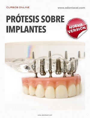 Curso de Prótesis sobre Implantes