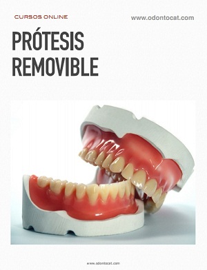 Curso de Prótesis Removible