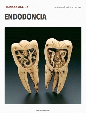 Curso de Endodoncia