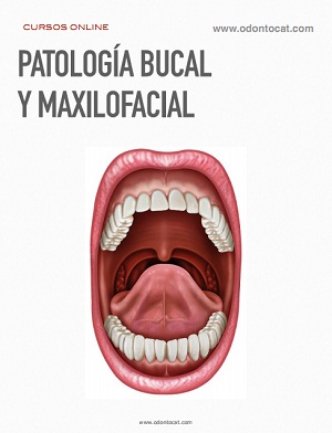 Curso de Patología Bucal y Maxilofacial